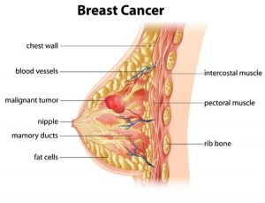 Breast cancer mammograms michigan